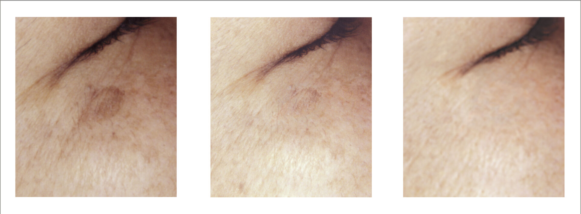 Before_After_目下[5118]